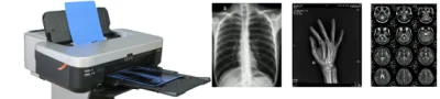 Impressora de filme a jato de tinta X Ray Impressora de filme seco Impressora de filme de imagem médica