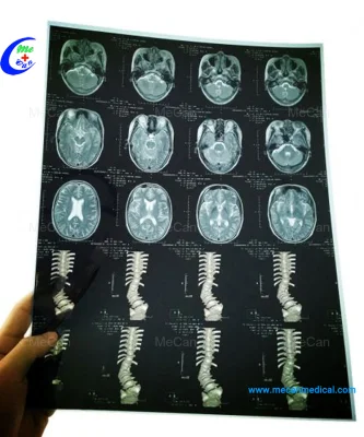 Filme seco médico X Ray do Inkjet da radiologia para a impressora do filme do hospital